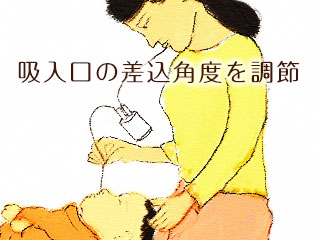 吸引器で赤ちゃんの鼻水を吸う母親
