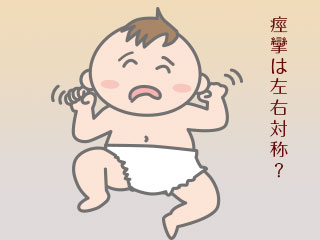 痙攣する赤ちゃん