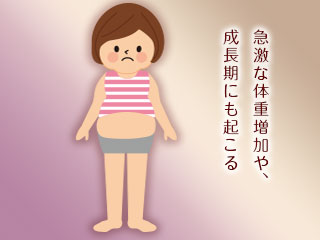 太った女性