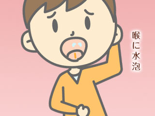 喉に水泡ができた子供
