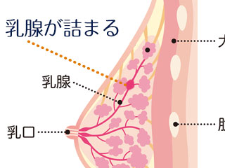 乳房断面図と乳腺のつまり