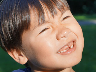 前歯がない子供