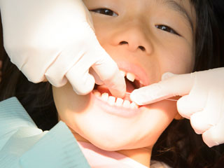 歯科医に歯の治療を受ける子供