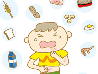 食品と蕁麻疹に泣く子供