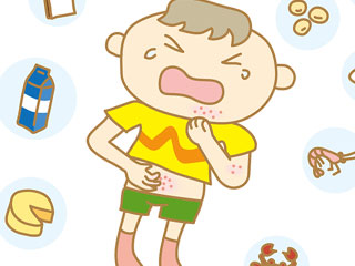 食物アレルギーを起こす子供