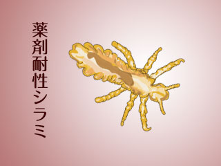 頭シラミ