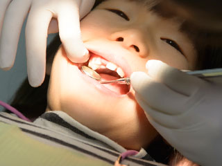 歯科医に歯を調べられる子供
