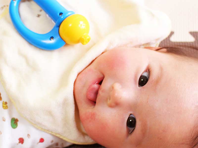湿疹でほっぺが少し赤くなってるけど笑顔の新生児