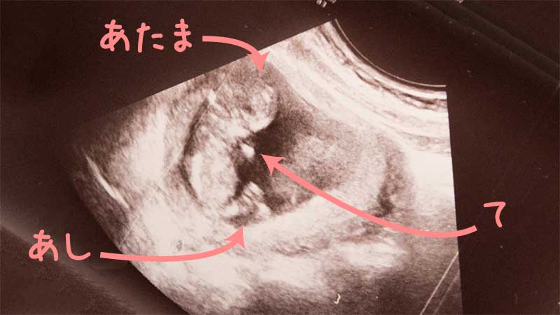 胎児はどう成長しているの?【妊娠週数別】赤ちゃんの成長 マーミー