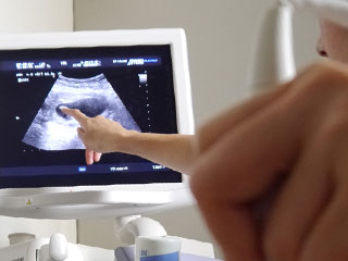 エコー画像で胎児を確認する医師