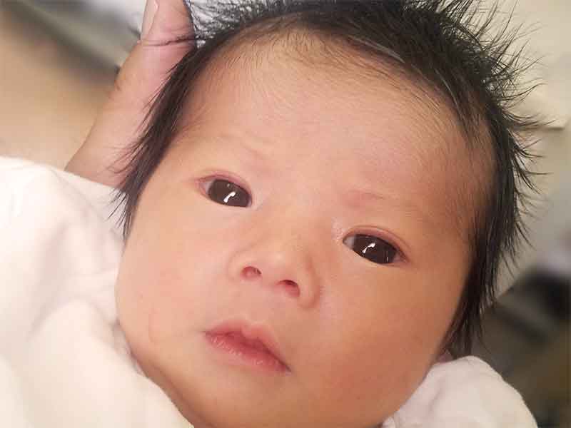 涙で眼が潤んでいるようにみる赤ちゃんの目