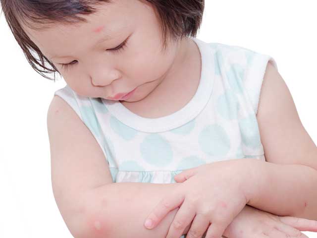自分の腕の水泡を見る幼児