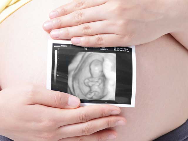 妊婦とエコー画像