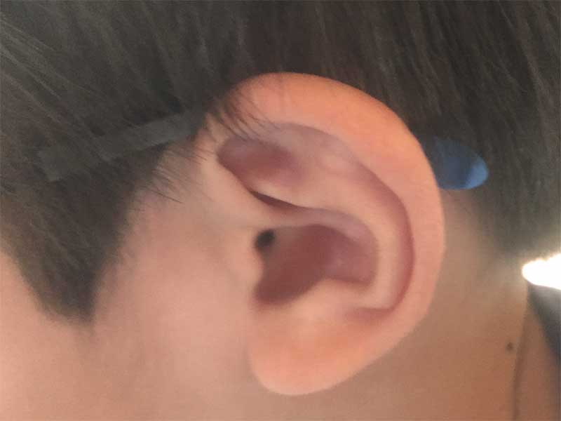 子供の耳
