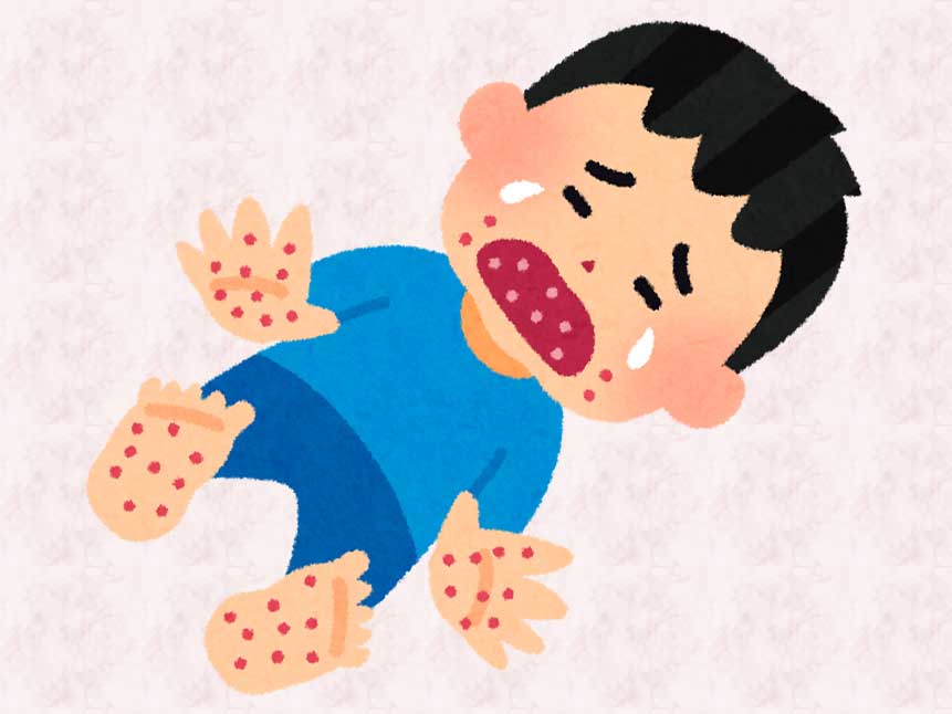 手足口病で泣いてる男の子
