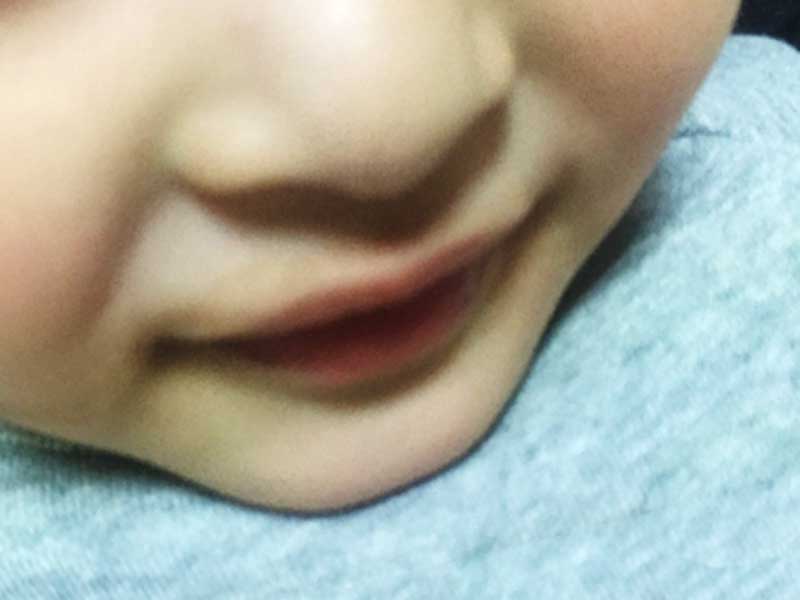 子供の唇