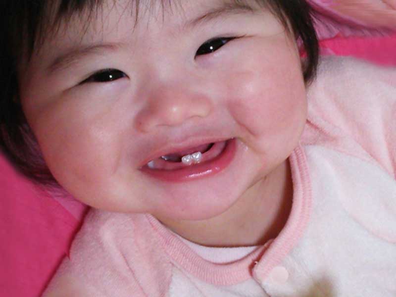 乳歯が入ってきている赤ちゃん