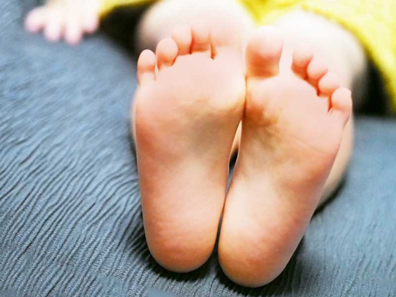 足の裏が赤くなっている子供