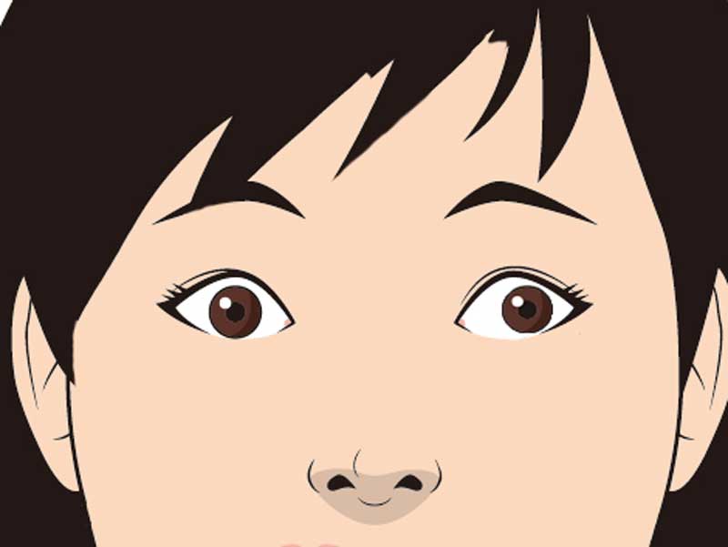 斜視の目のイラスト