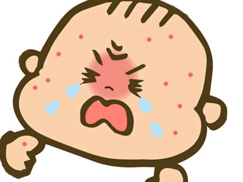 麻疹になった赤ちゃんのイラスト
