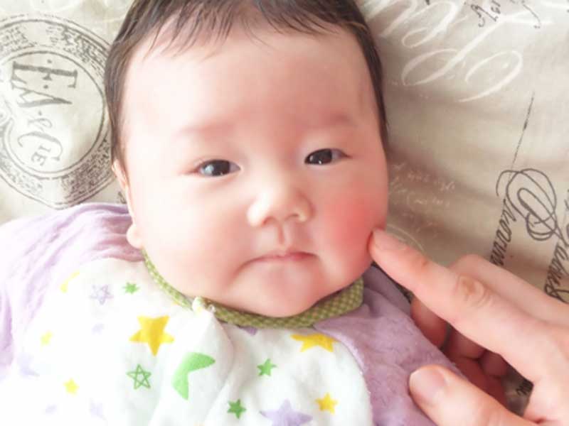 ほっぺたの片方だけが赤い赤ちゃん
