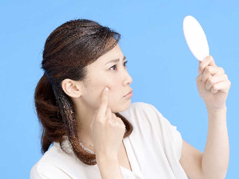 顔のニキビを気にしている女性