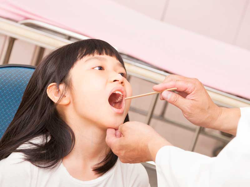 医師に舌を見てもらう子供