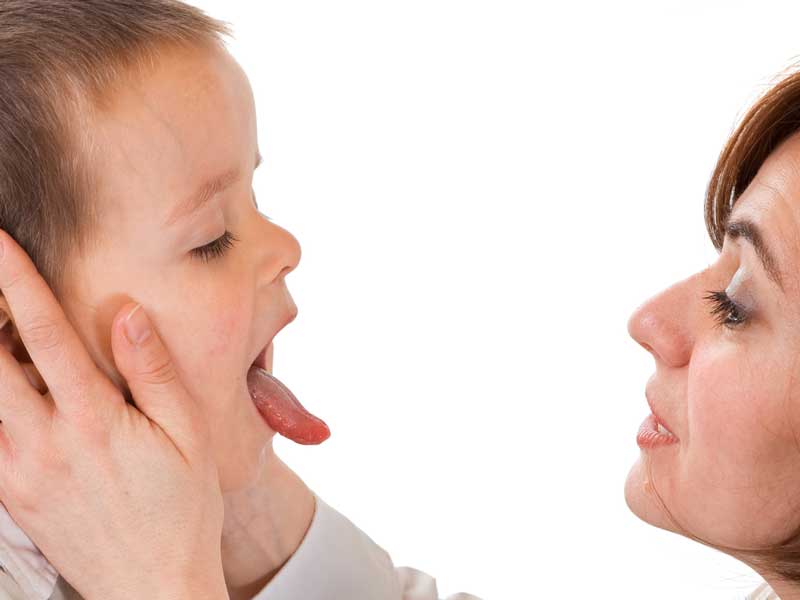 子供の舌をチェックするお母さん