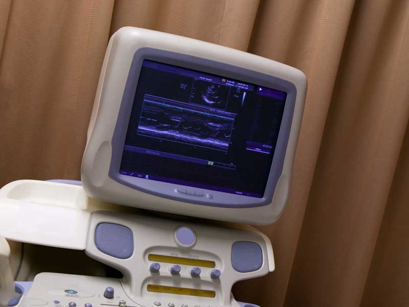 超音波検査の医療器械