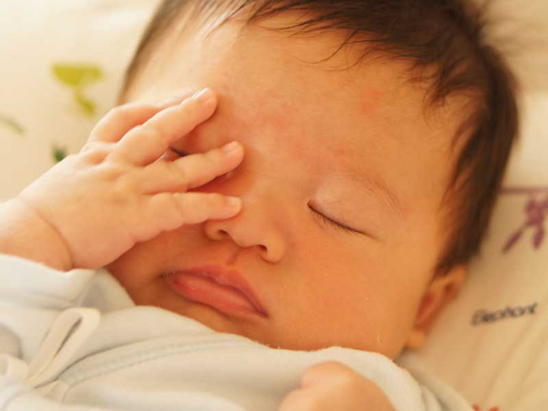 目の中にまつ毛が入っている赤ちゃん