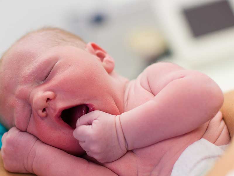 唇と肌が紫の新生児