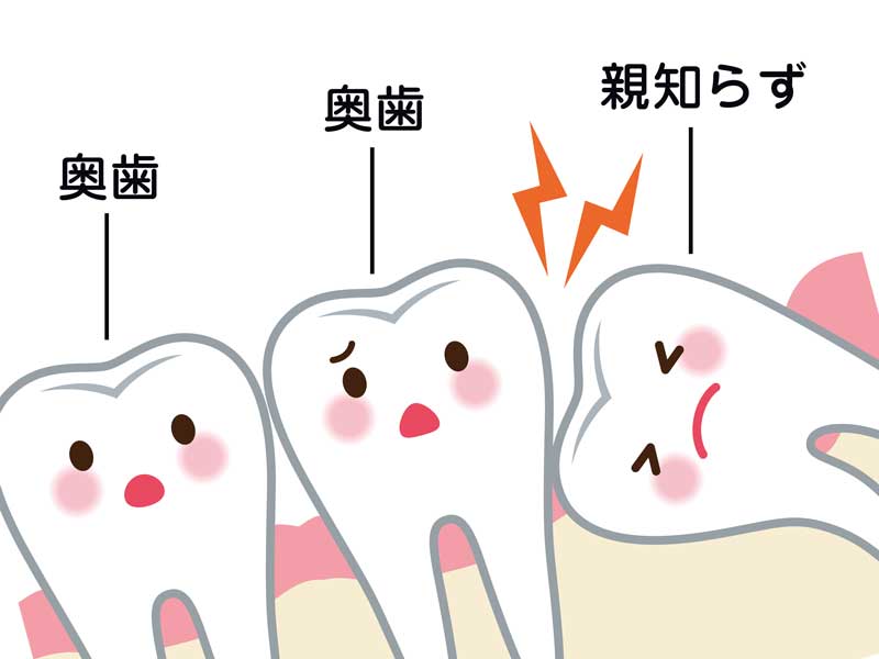 親知らずのイラスト