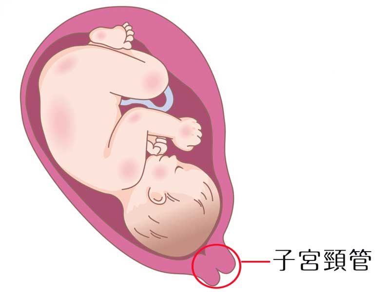 子宮頸管のイラスト