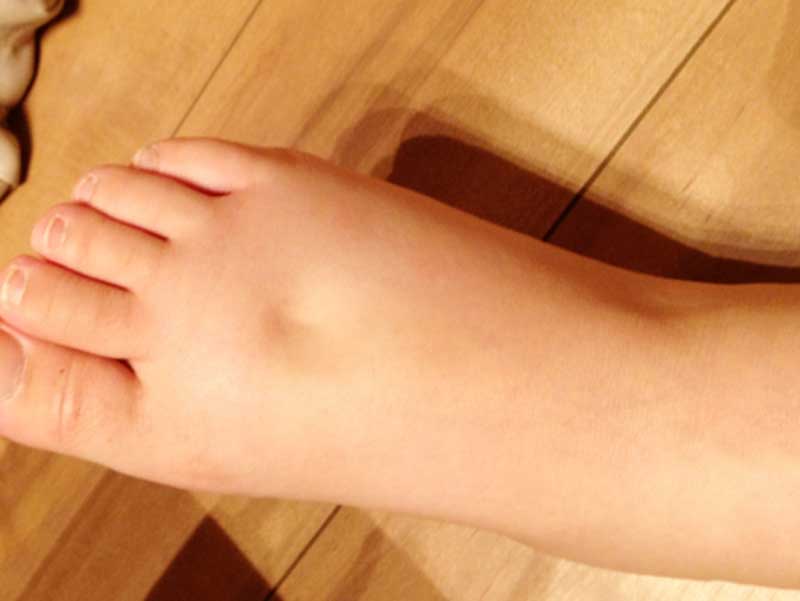 妊婦さんの浮腫んでいる足