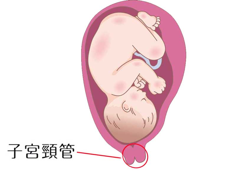 子宮頸管のイラスト