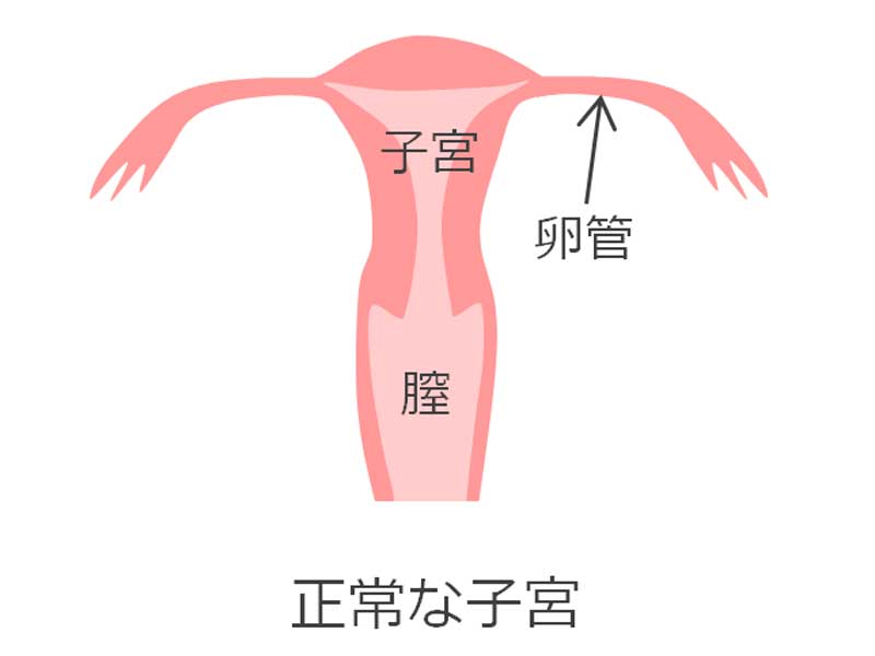 正常の子宮のイラスト