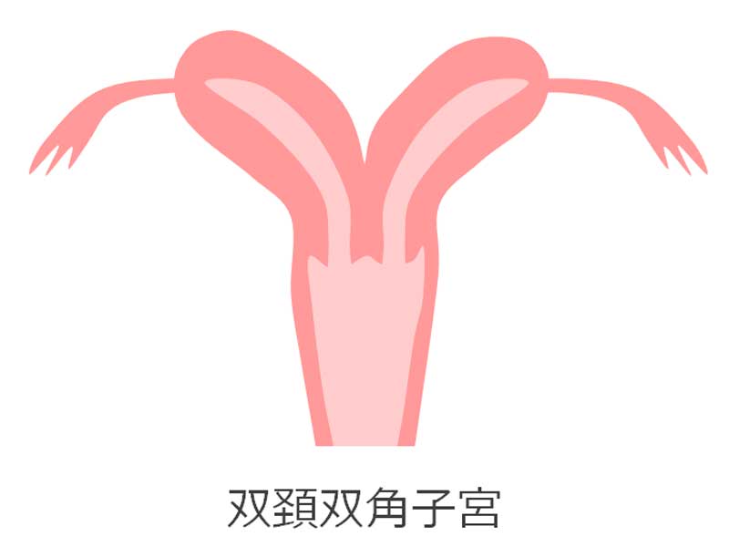 双頚双角子宮のイラスト