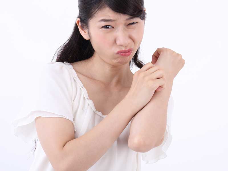 蕁麻疹の妊婦さん