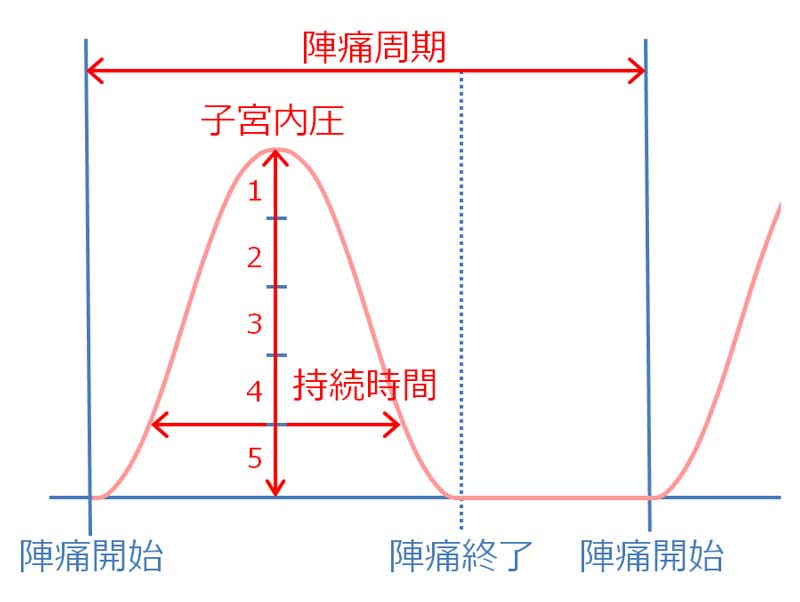 陣痛周期表