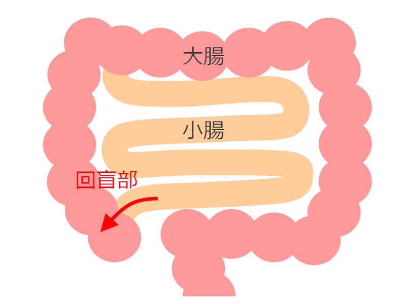 回盲部のイラスト
