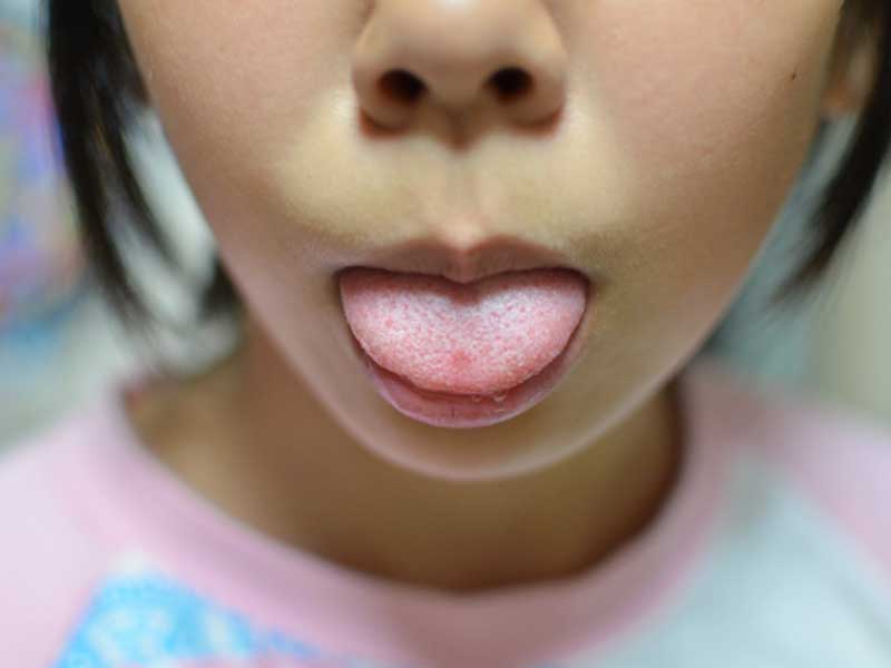口の中い違和感を感じ舌を出している女の子
