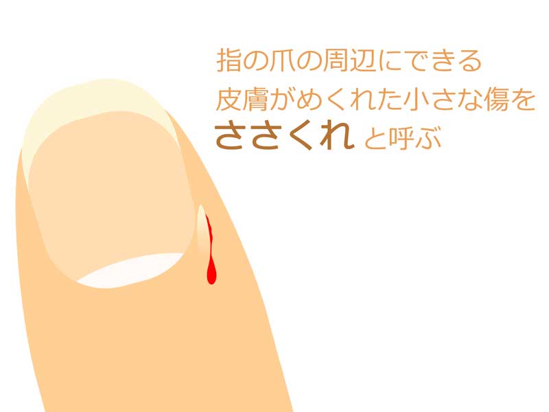 ささくれのイラスト