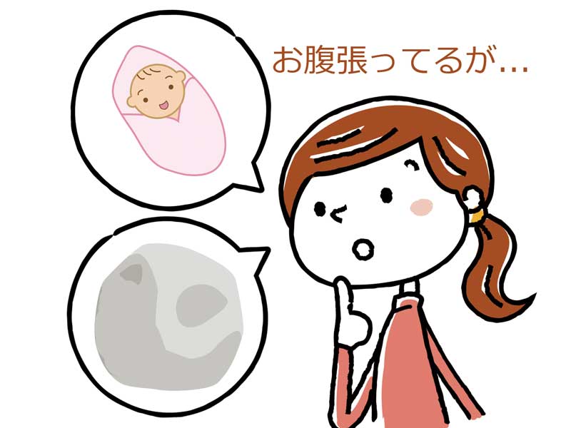 お腹が張っている妊婦さんのイラスト