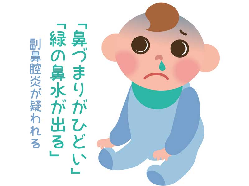 鼻水が出る赤ちゃんのイラスト