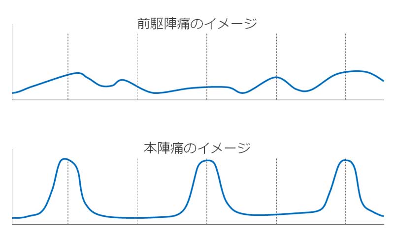 陣痛のイメージのグラフ