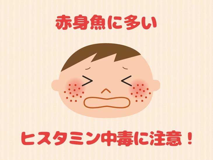 アレルギーの子供のイラスト