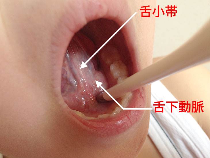 舌下動脈に体温計をあてている男の子の口内