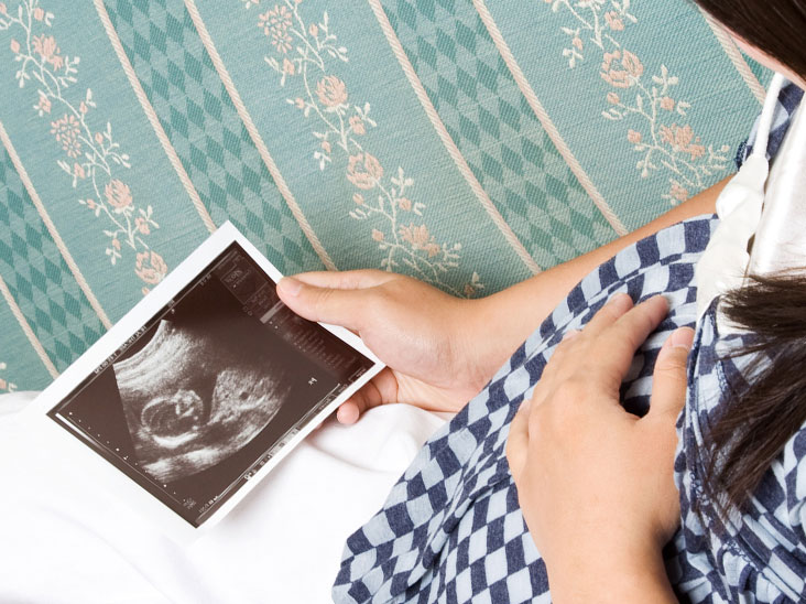 赤ちゃんのエコー写真を見る妊婦さん