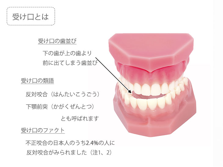 受け口解説イメージ