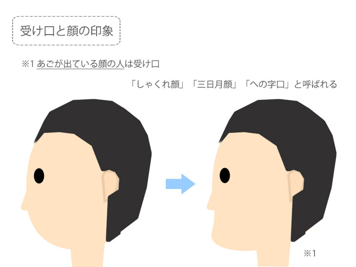 受け口と顔の印象解説イメージ